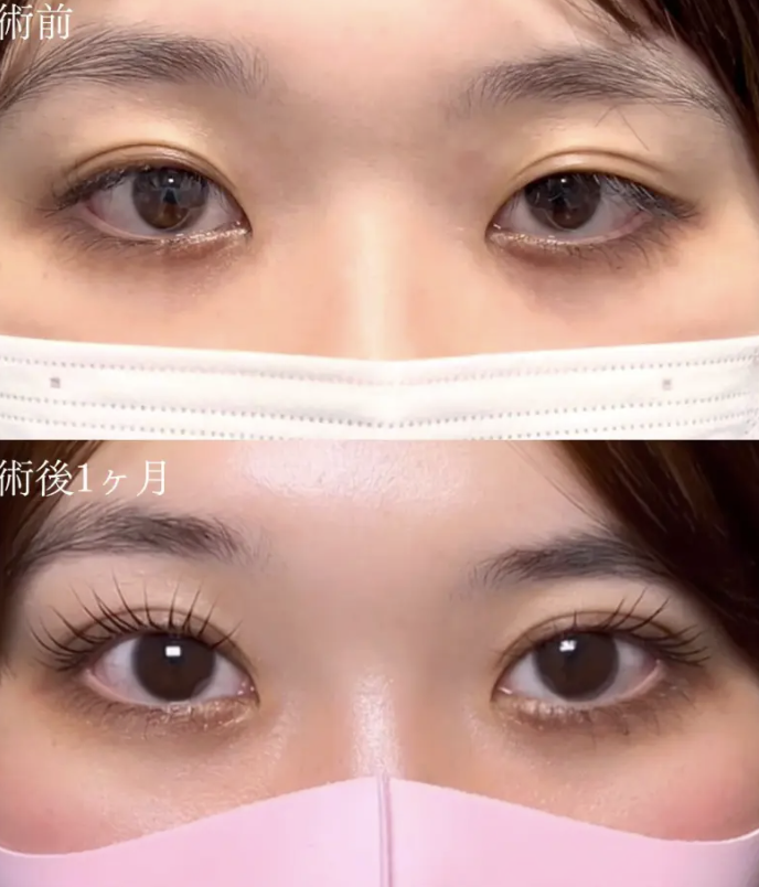 Days Beauty Clinic原田医師の症例画像