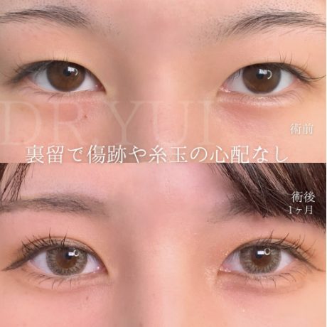 e clinic 横浜みなとみらい院 坂本 優衣 医師の症例画像