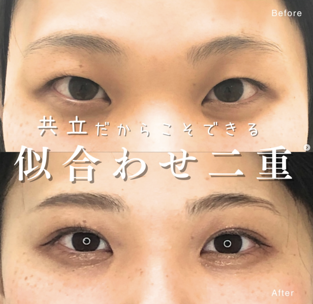 共立美容外科 銀座院 遠山 貴之 医師の症例画像