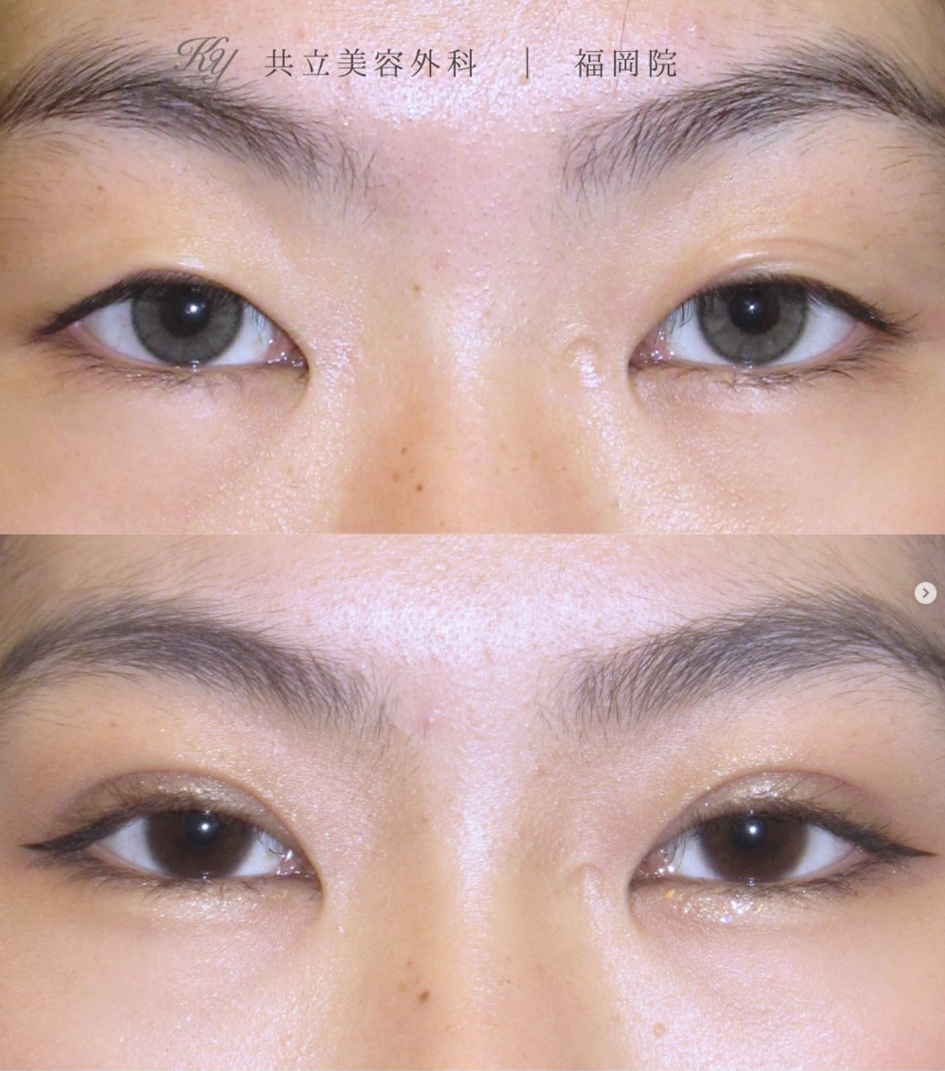 鈴木 康公 医師(共立美容外科 福岡院)の症例画像