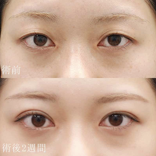 水の森美容クリニック 東京渋谷院 古村 陽典 医師の症例画像