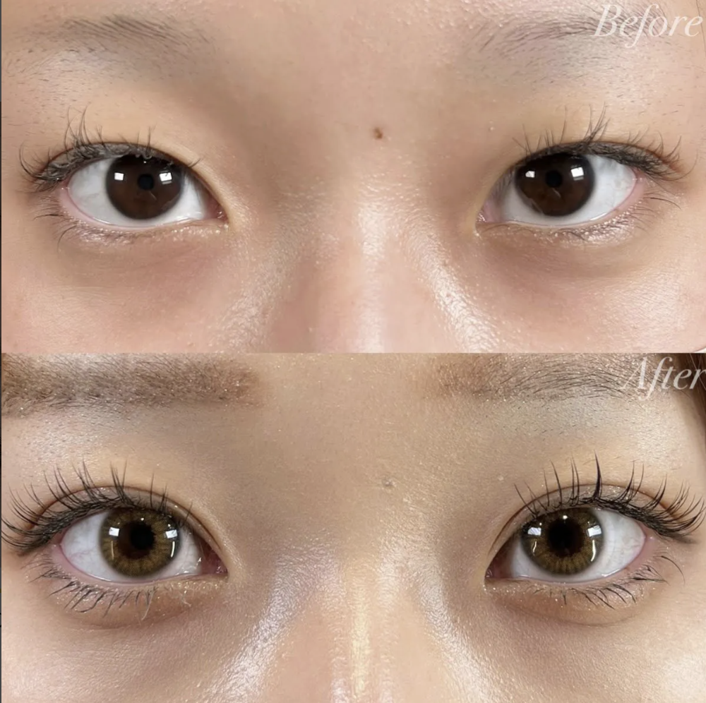 R Beauty CLINIC 銀座院 富田 莉沙子 医師の症例画像