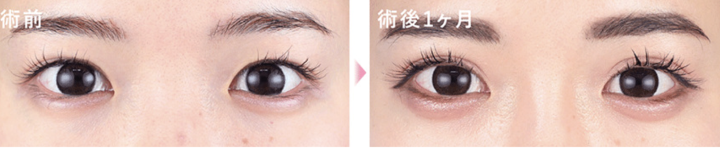 鴨田 隆弘 医師(湘南美容クリニック 福岡院) の症例画像