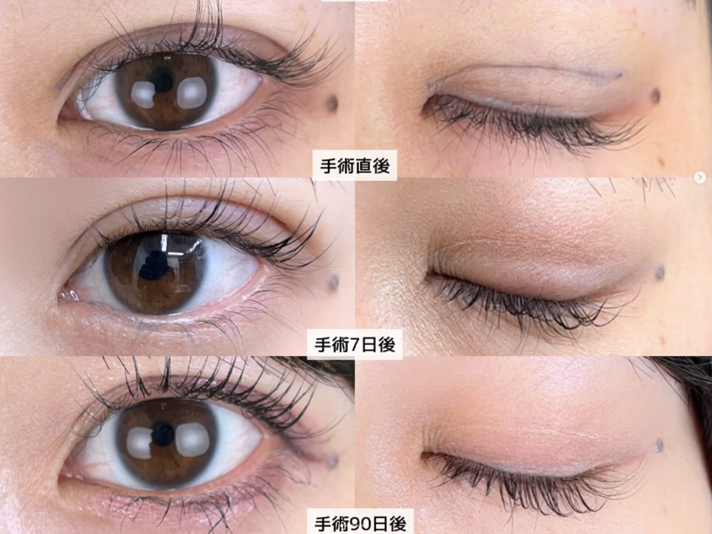 湘南美容クリニック 名古屋駅本院 高川 裕也 医師の症例画像