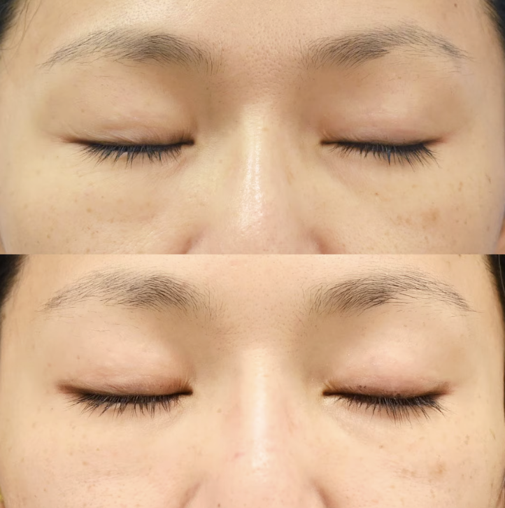 池内 理絵 医師(梅田茶屋町院院長 ※皮膚科教育担当)の症例画像