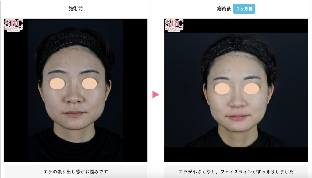 樺山 翔平 医師(広島院※皮膚科教育担当)の症例画像