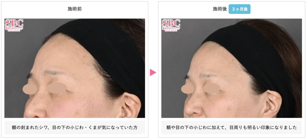 sbc松原 譲二 医師(新宿本院)の症例画像