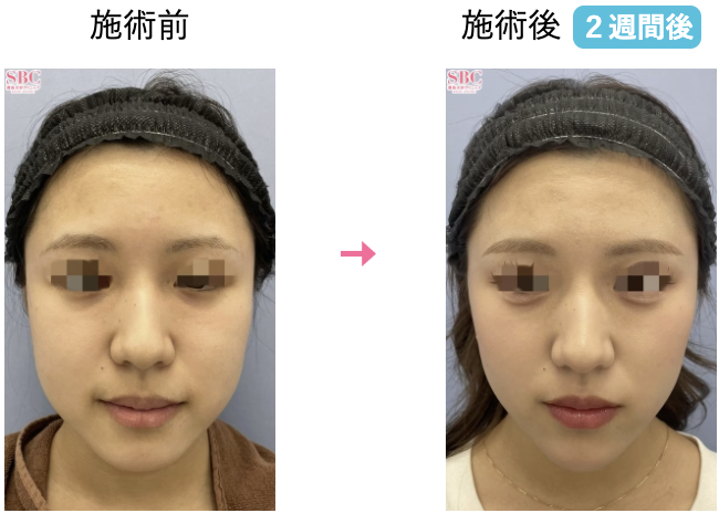 宮崎 恵子 医師(福岡院副院長)の症例画像