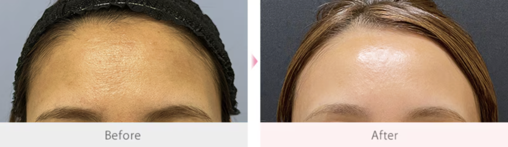 佐藤 公美 医師(大阪あべの院)の症例画像