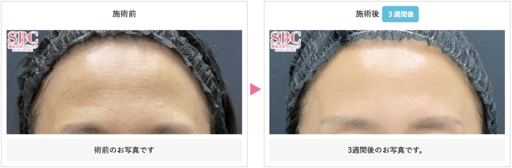 sbc脇田 理絵 医師(原宿院)の症例画像