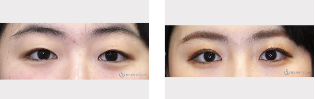 聖心美容クリニック 福岡院 美原 寿之 医師の症例画像