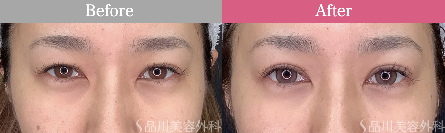 品川美容外科 上野院 大貫 祐輝 医師の症例画像