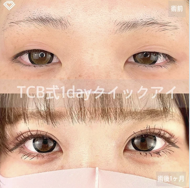 植木 翔也 医師(TCB東京中央美容外科 福岡天神院)の症例画像