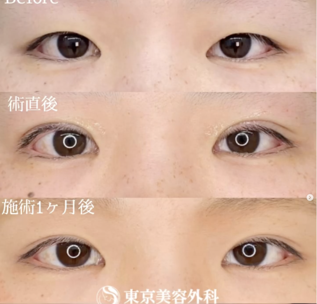 東京美容外科 梅田院 木村 幸志伊 医師の症例画像