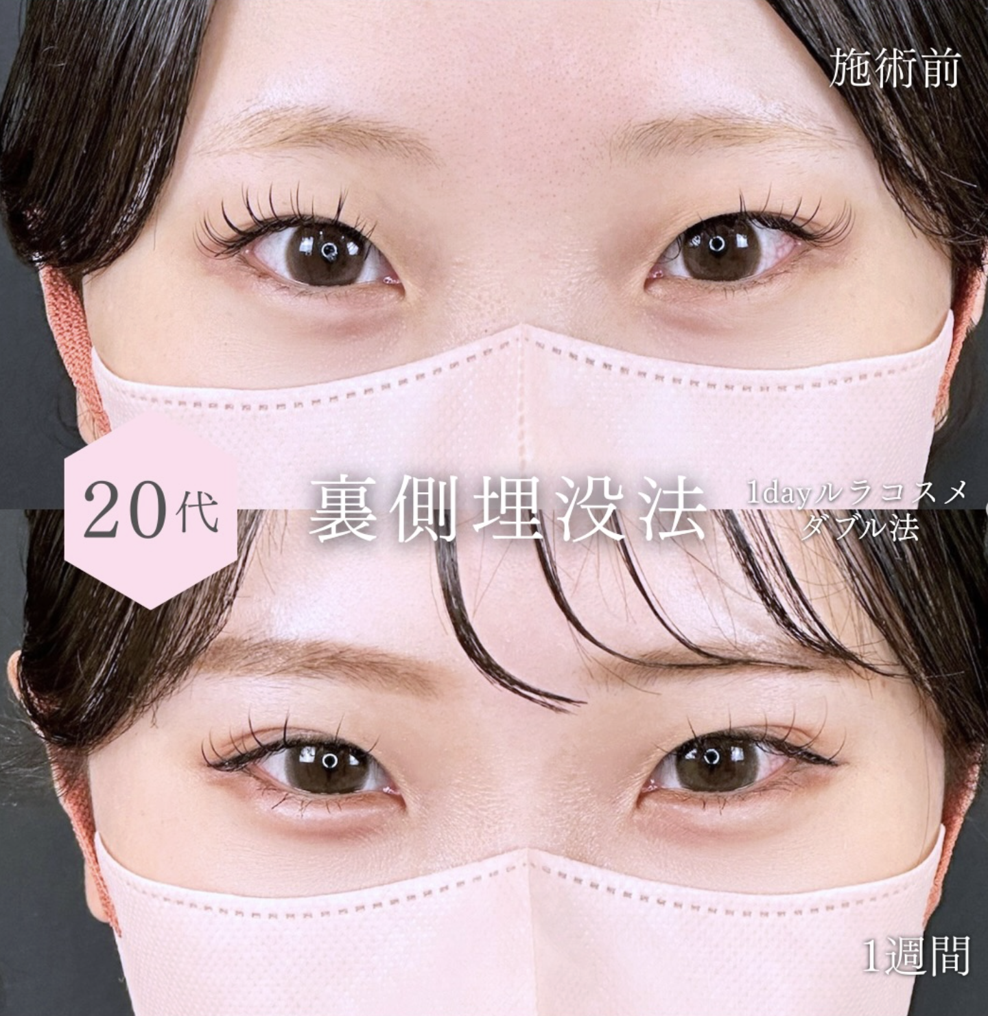 樋勝 政博 医師 ルラ美容クリニックの症例画像