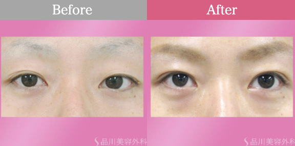 吉池 剛 医師 品川美容外科の症例画像