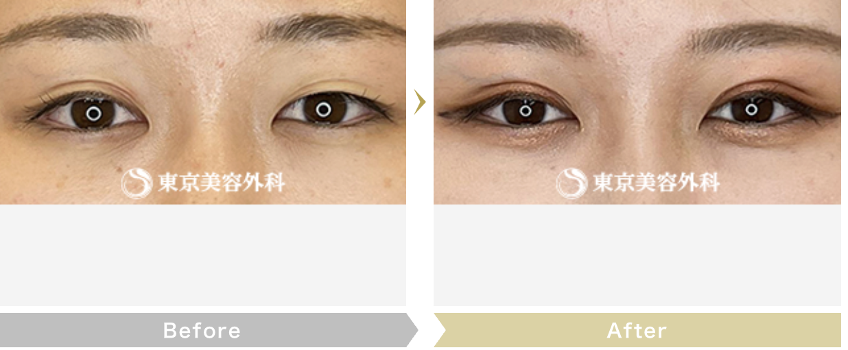 田中 宏明 医師（東京美容外科の症例画像