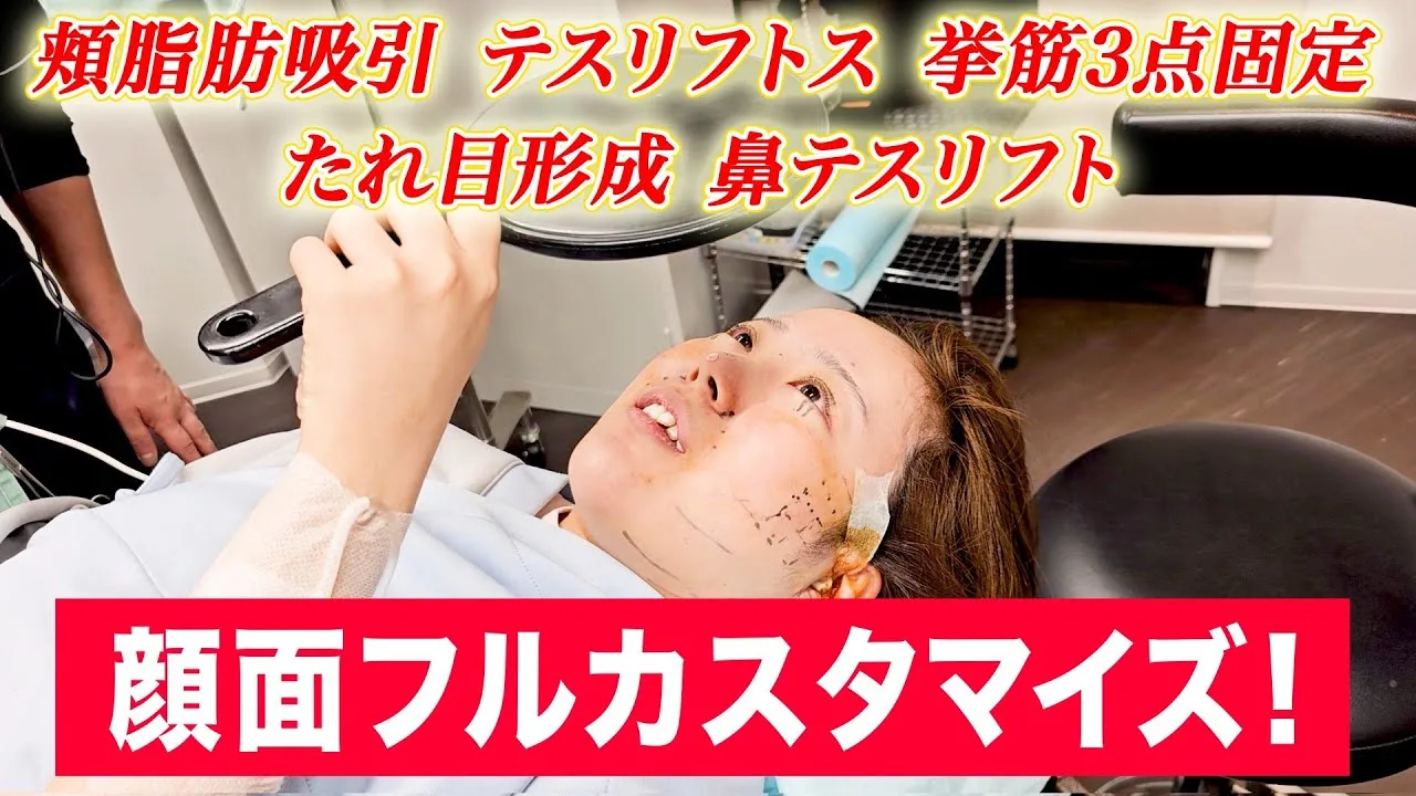 顔の美容整形は複数同時にできる？5施術を組み合わせた症例と1週間のダウンタイム