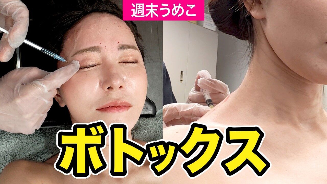 美容医療は何から始める？ボトックスが検討しやすい理由と部位の選び方